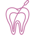 Odontología Conservadora en Murcia - Endodoncia | Clínica Dental Ángel Samaniego