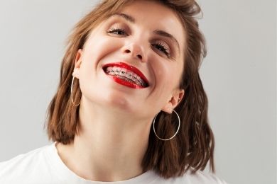 Ortodoncia - Dentista en Murcia | Clínica Dental Ángel Samaniego