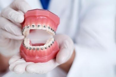 Ortodoncia en Murcia | Clínica Dental Ángel Samaniego